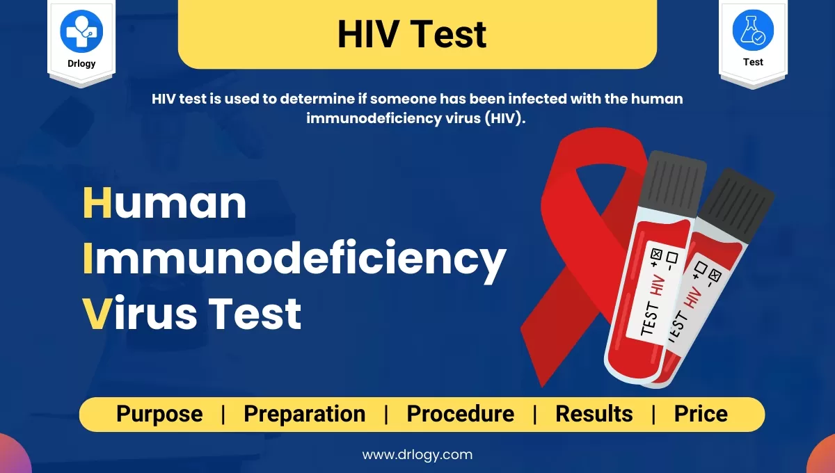 HIV (Human Immunodeficiency Virus) Test For Sexual Infection